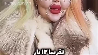 رکورد بیش ترین جراحی زیبایی