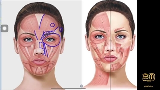 آموزش تزریق بوتاکس _ تزریق بوتاکس _ آناتومی عضلات صورت ۱ (جلسه۲)