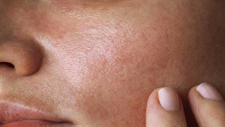 هفت عادت روزانه که پوست را خراب می‌کند