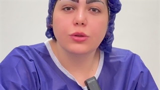 کاشت ابروی سوپر نچرال با 5 زاویه طبیعی