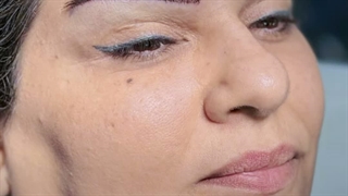 کاشت ابرو به روش استاندارد و بدون جای زخم