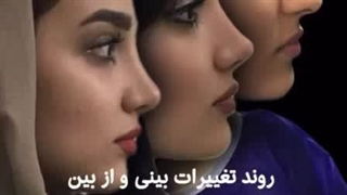 روند تغییرات بینی بعد از رینوپلاستی