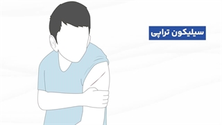 موثرترین روش ها برای درمان جای زخم