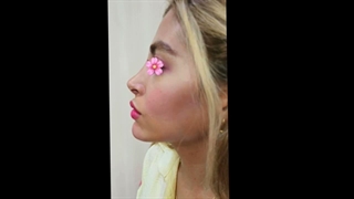 نمونه‌کارهای کلینیک دکتر خیرآبادی (7)
