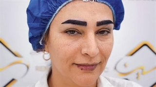 کاشت ابرو به روش استاندارد و بدون جای زخم