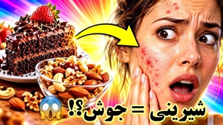 چرا بعد از خوردن شیرینی جوش می‌زنیم؟ علت جوش صورت + روش‌های جلوگیری و درمان خانگی