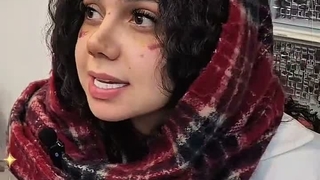 نمونه کار واقعی و رضایت بعد از عمل بینی گوشتی